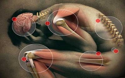 Symptoms of Somatoform Ailments in Indian Rural
Women: Does that Raise an Alarm?