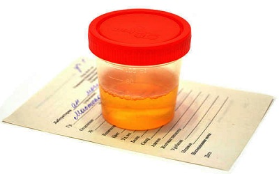 Orange Coloured Urine Following a Lower Segment Cesarean Section: A Case Report