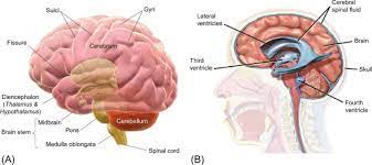 Dehydrated Brain Sign: Hyperosmolar Cerebral Tissue Contraction