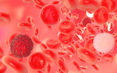 Autoimmune hemolytic anemia in chronic lymphocytic leukemia