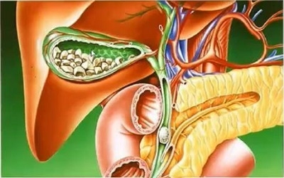 An Approximation Technique for Primary Anastomosis (Gazi Method) In Selected Cases of Long Gap Esophageal Atresia