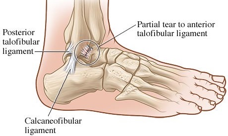 Modern View on Physical Rehabilitation with Ankle Injury