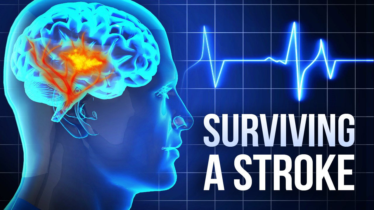 Awareness of Stroke among Teachers in Asser Region, Saudi Arabia