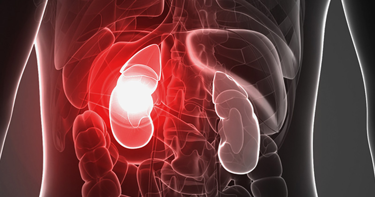 Comparative Protective Effect of Zileuton and MK-886 against Acute Kidney Injury Induced by Doxorubicin