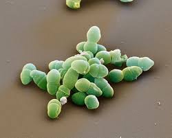 Etiological Structure and In Vitro Susceptibility to Antimicrobial Agents from Blood Cultures in Bulgarian Multi profile Hospital, 2015-2016