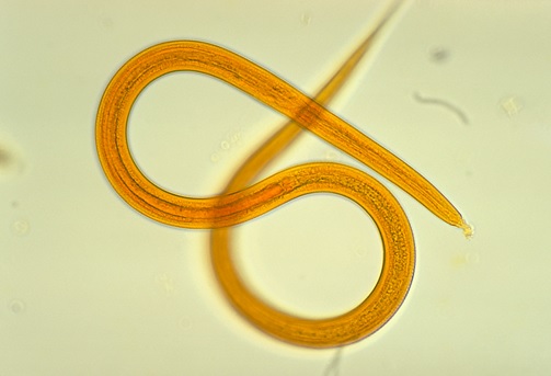 Fatal Disseminated Strongyloidiasis Secondary to Corticosteroid Use: A Report of Two Cases