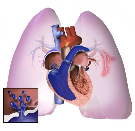 Asian Pulmonology Summit