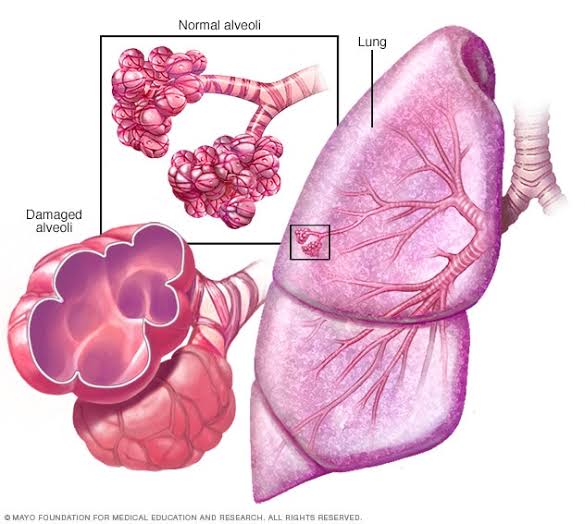 2020 Announcement of International Conference on Pulmonary Disorder