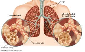 Young Scientist Awards of Chronic Obstructive Pulmonary Disease