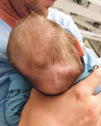 A Brief Note on Pediatric Ophthalmology