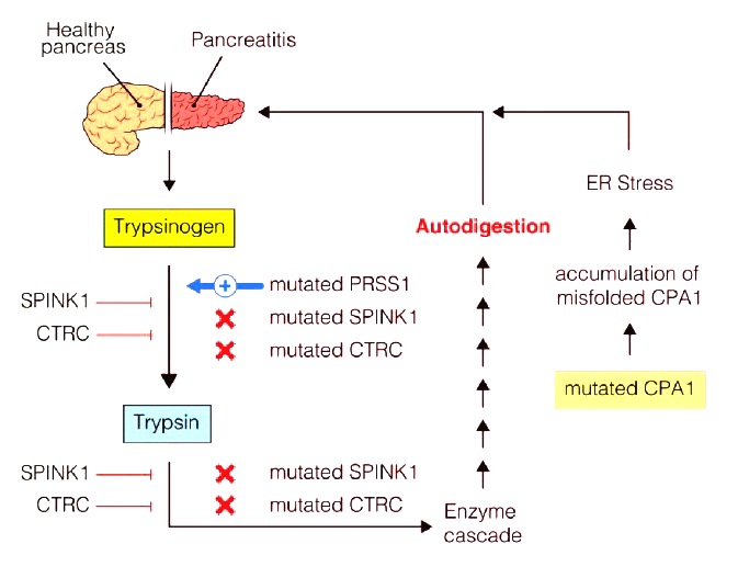 Acute Recurrent Pancreatitis in a Child Heterozygous for the N34S SPINK1 Gene Mutation