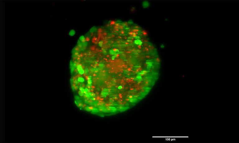 Scope in Biophotonics