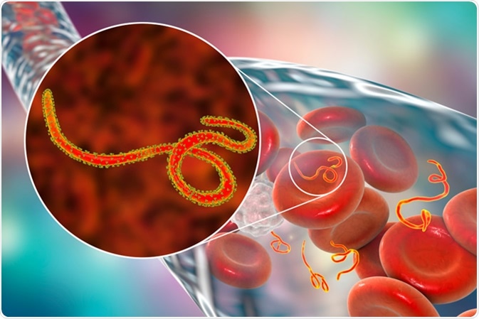 Development Research and Progress on Ebola virus