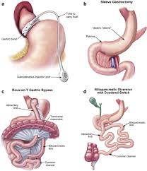 Young Researchers Forum - Young Scientist Awards Gastroenterology 2020