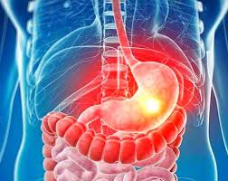 16th World Congress on Gastroenterology & Therapeutic