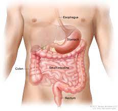 Delayed Diagnosis of a GIST: A Case Report from a Resourcelimited Setting