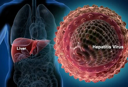 Hepatitis Alludes to Aggravation of Liver Tissue
