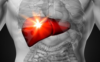 An Unusual Case of Dyspnoea in a Patient with Chronic Liver Disease