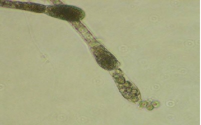 Taxonomic notes on Allomyces neomoniliformis (Blastocladiaceae) isolated from Nanital lake, Uttarakhand, India